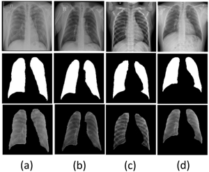 TB Detection